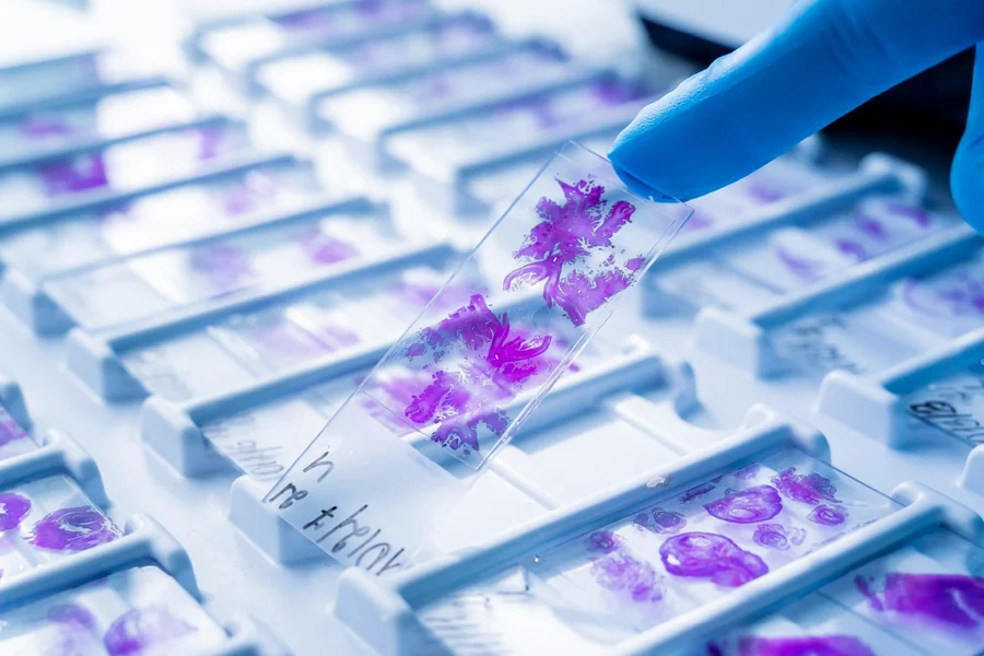 How FFPE Slides Support Pathology and Molecular Analysis