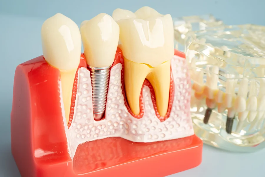 Mouthguards and Bad Breath: Is Your Sports Guard Actually Hygienic? 