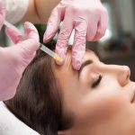 The Benefits of RF Microneedling in Sydney